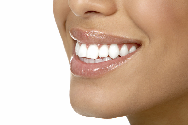 Beschikbaar artillerie Respectievelijk 10 tips voor natuurlijk witte tanden | TheBeautyMusthaves